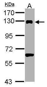 DDB1 Antibody in Western Blot (WB)