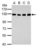 DDB1 Antibody in Western Blot (WB)