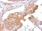 CCR8 Antibody in Immunohistochemistry (Paraffin) (IHC (P))