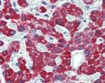 ACADS Antibody in Immunohistochemistry (Paraffin) (IHC (P))