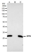 14-3-3 sigma Antibody in Immunoprecipitation (IP)