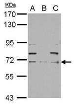 NEFL Antibody in Western Blot (WB)