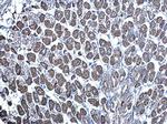 mTOR Antibody in Immunohistochemistry (Paraffin) (IHC (P))