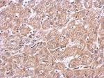 mTOR Antibody in Immunohistochemistry (Paraffin) (IHC (P))