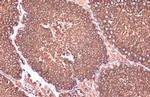 Calnexin Antibody in Immunohistochemistry (Paraffin) (IHC (P))