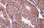 Calnexin Antibody in Immunohistochemistry (Paraffin) (IHC (P))