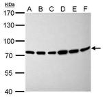 Moesin Antibody in Western Blot (WB)