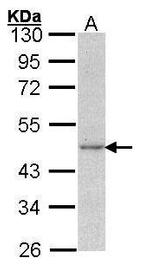 gamma Actin Antibody in Western Blot (WB)