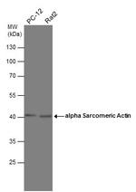 gamma Actin Antibody in Western Blot (WB)