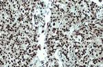 53BP1 Antibody in Immunohistochemistry (Paraffin) (IHC (P))