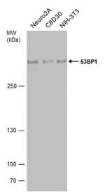 53BP1 Antibody in Western Blot (WB)