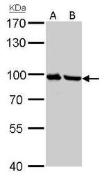 Plasminogen Antibody in Western Blot (WB)