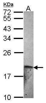 Endothelin 2 Antibody in Western Blot (WB)