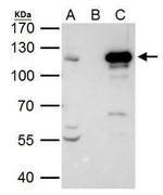 STAT2 Antibody in Immunoprecipitation (IP)