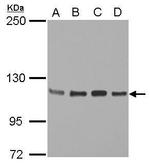 STAT2 Antibody in Western Blot (WB)