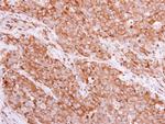 BIN1 Antibody in Immunohistochemistry (Paraffin) (IHC (P))