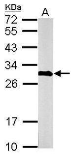 Calretinin Antibody in Western Blot (WB)