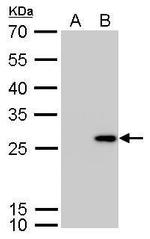 Calretinin Antibody in Western Blot (WB)