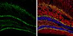 Calretinin Antibody in Immunohistochemistry (Frozen) (IHC (F))