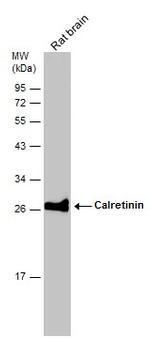 Calretinin Antibody in Western Blot (WB)