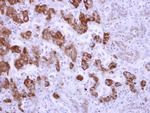 ALDH6A1 Antibody in Immunohistochemistry (Paraffin) (IHC (P))