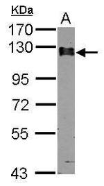 Calpastatin Antibody in Western Blot (WB)