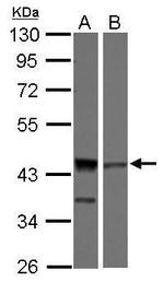 ICAD Antibody in Western Blot (WB)