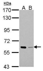 PAK1 Antibody in Western Blot (WB)