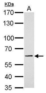 PAK1 Antibody in Western Blot (WB)