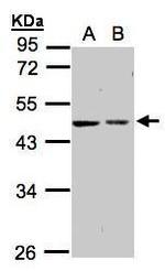 GALK2 Antibody in Western Blot (WB)