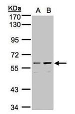 C18orf14 Antibody in Western Blot (WB)