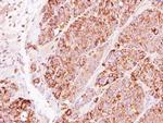 TBRG4 Antibody in Immunohistochemistry (Paraffin) (IHC (P))