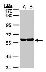 TBRG4 Antibody in Western Blot (WB)