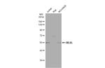 MLKL Antibody in Western Blot (WB)