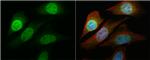 NFkB p65 Antibody in Immunocytochemistry (ICC/IF)