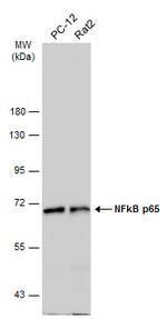 NFkB p65 Antibody in Western Blot (WB)