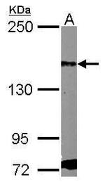 PDGFRA Antibody in Western Blot (WB)