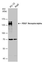 PDGFRA Antibody in Western Blot (WB)