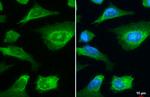 LIMCH1 Antibody in Immunocytochemistry (ICC/IF)