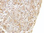 LIMCH1 Antibody in Immunohistochemistry (Paraffin) (IHC (P))