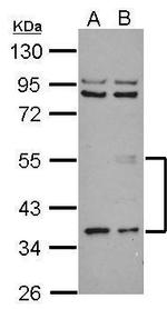 ANGPTL3 Antibody in Western Blot (WB)