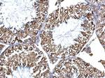 Calnexin Antibody in Immunohistochemistry (Paraffin) (IHC (P))