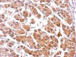 PUMA alpha Antibody in Immunohistochemistry (Paraffin) (IHC (P))