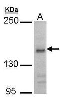 NMDAR2B Antibody in Western Blot (WB)