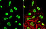 Ku80 Antibody in Immunocytochemistry (ICC/IF)