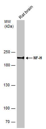 NF-H Antibody in Western Blot (WB)