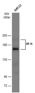 NF-H Antibody in Western Blot (WB)