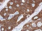 Cytokeratin 8 Antibody in Immunohistochemistry (Paraffin) (IHC (P))