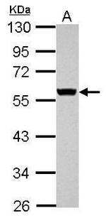 Cytokeratin 8 Antibody in Western Blot (WB)