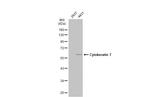 Cytokeratin 7 Antibody in Western Blot (WB)